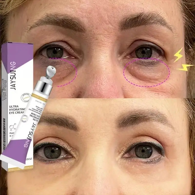 Instant Eye Bag Removal Cream